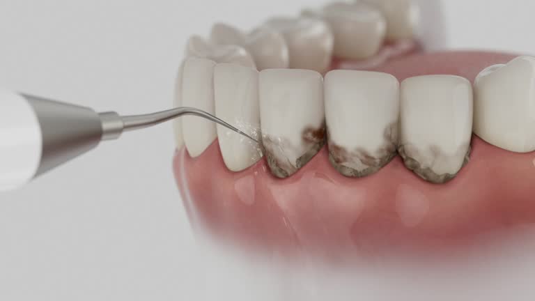 Reliable Tooth Extraction contractor in DeKalb County County, GA by Dentist Open Now
